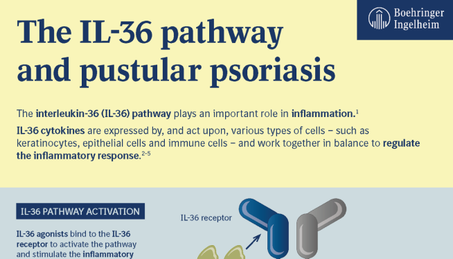 Learn about the disease pathway for GPP and IL‑36