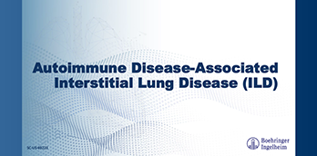 Autoimmune Disease-Associated Interstitial Lung Disease - Slide Deck