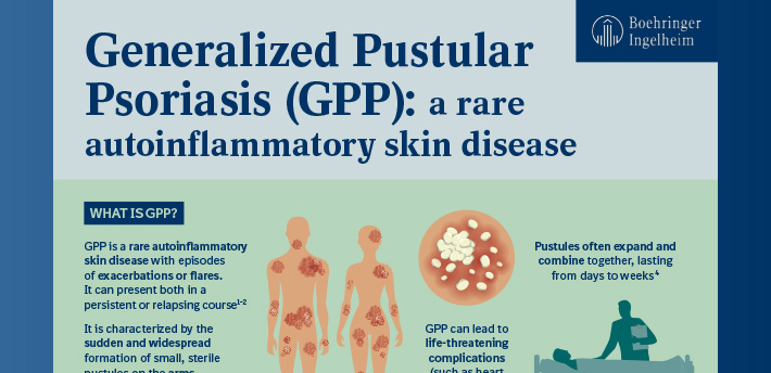 Generalized Pustular Psoriasis Infographic