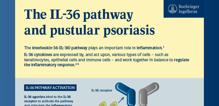 The IL-36 Pathway and Pustular Psoriasis Infographic