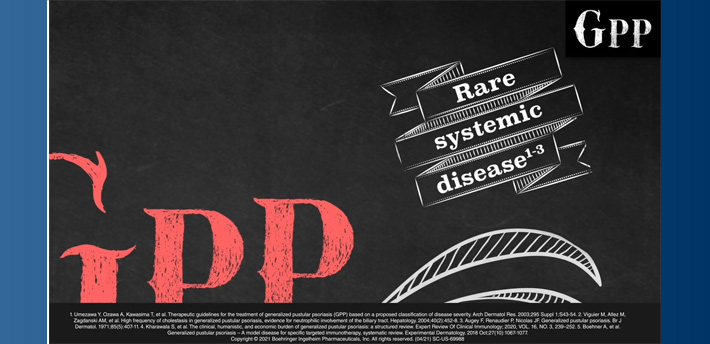 GPP Blackboard Animation – Immunology