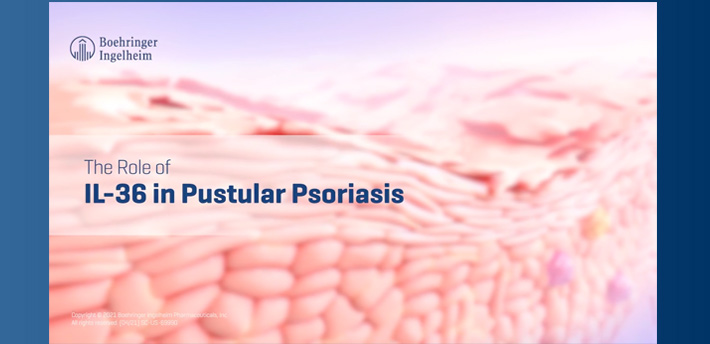 MOA Video Module 2 – The Role of IL-36 in Pustular Psoriasis
