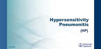 Hypersensitivity Pneumonitis - Slide Deck