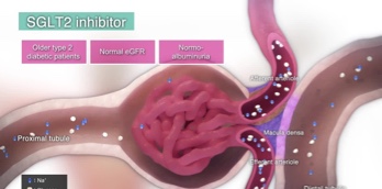 SGLT2 Inhibition and Diabetes - Video