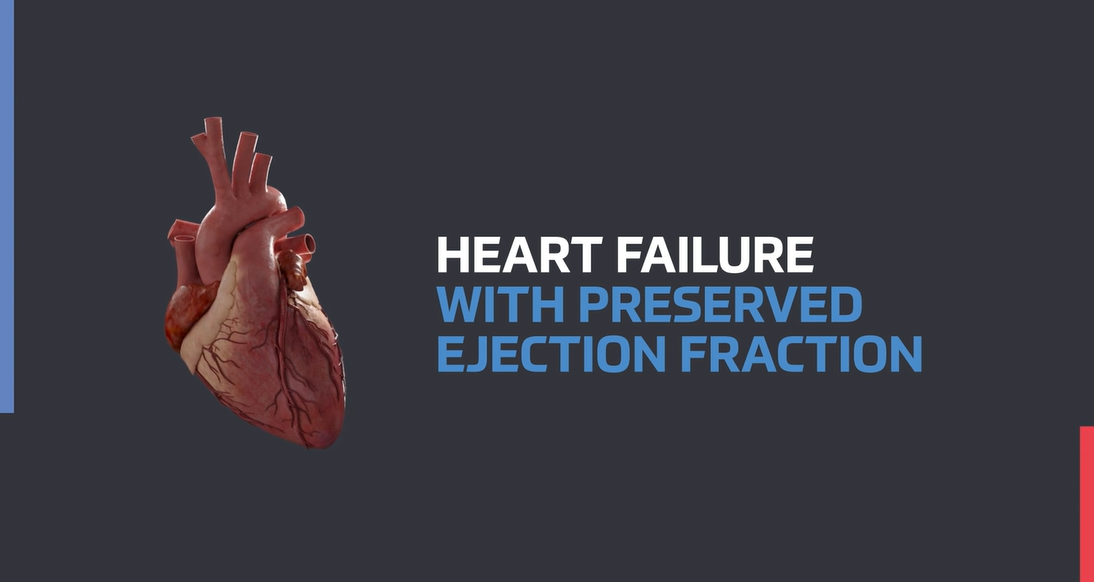 Heart Failure with Preserved Ejection Fraction - Video